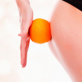 La Cellulite
