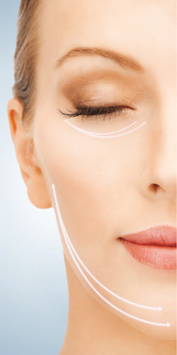 Soft Lifting - Medicina Estetica Brescia